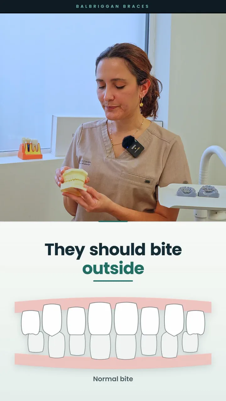 Jenny demonstrating a dental model above a crossbite illustration in the finished video